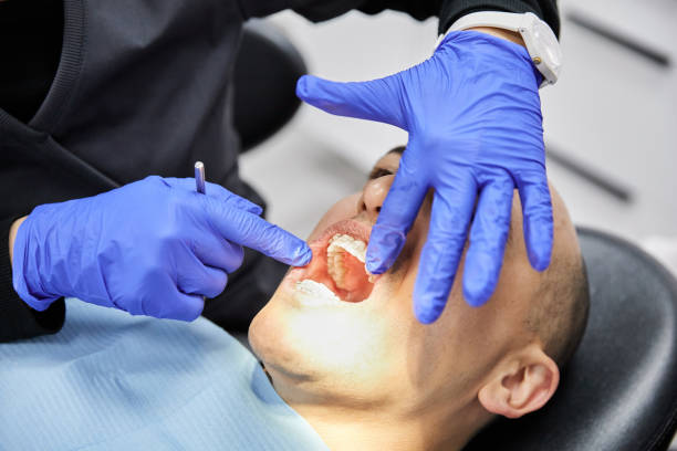 Best Emergency Treatment for Toothache in Cabin John, MD